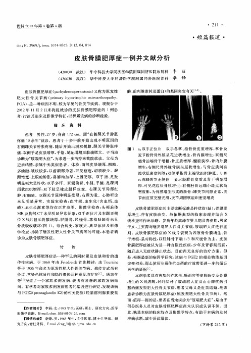 皮肤骨膜肥厚症一例并文献分析