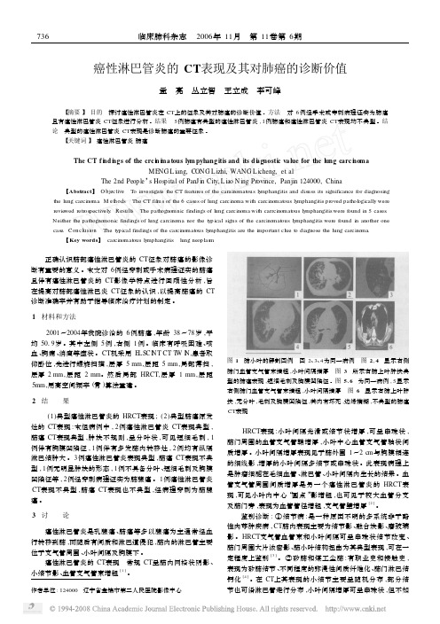 癌性淋巴管炎的CT表现及其对肺癌的诊断价值