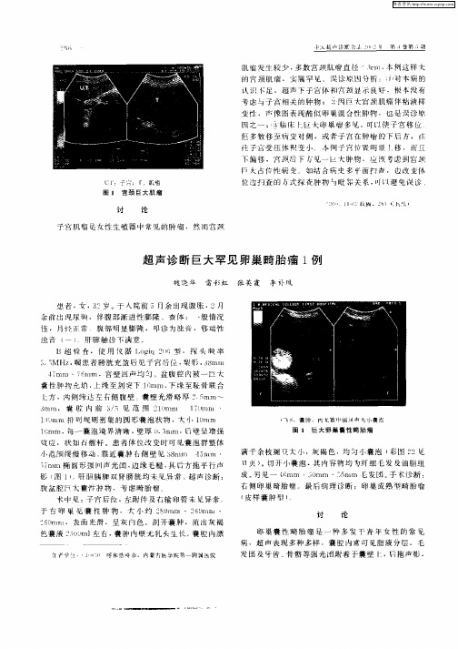 超声诊断巨大罕见卵巢畸胎瘤1例