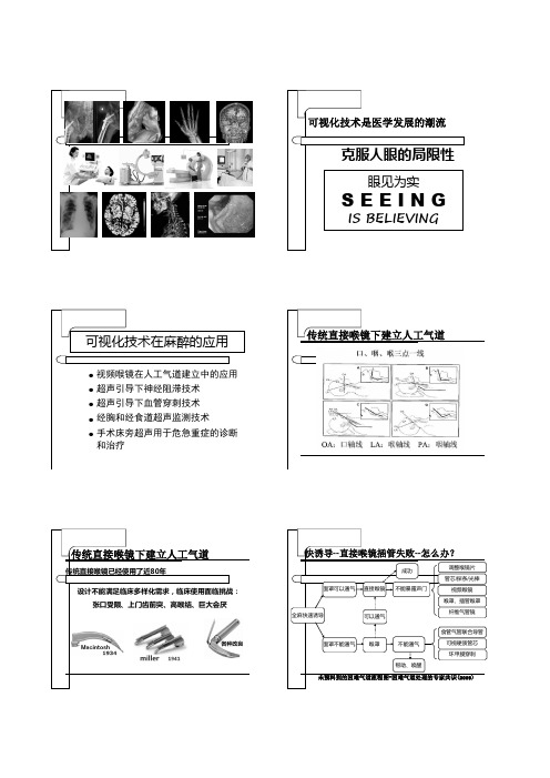 视频气管插管技术