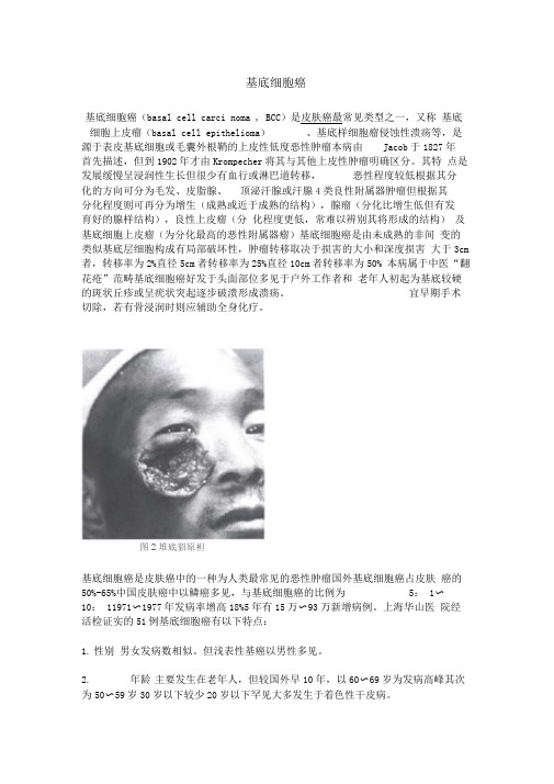 基底细胞癌
