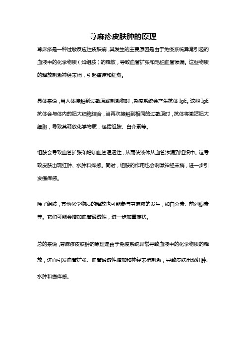 荨麻疹皮肤肿的原理
