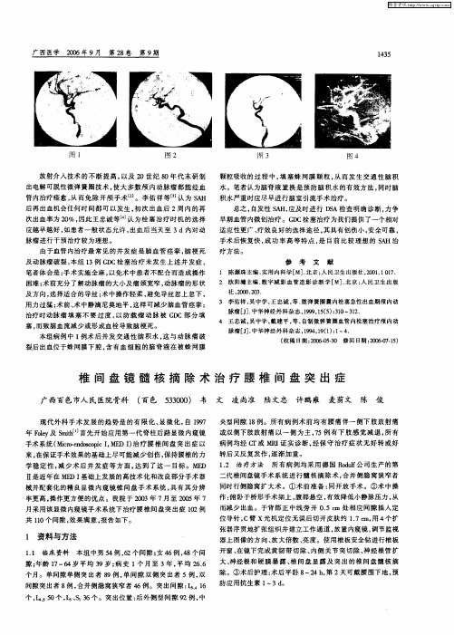 椎间盘镜髓核摘除术治疗腰椎间盘突出症