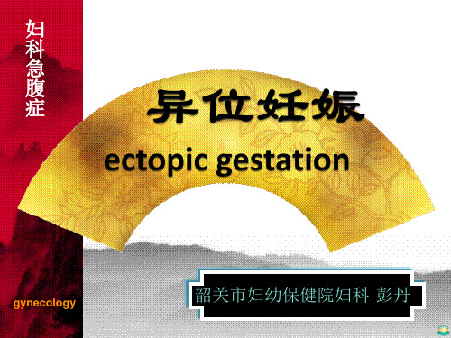 异位妊娠输卵管妊娠PPT课件