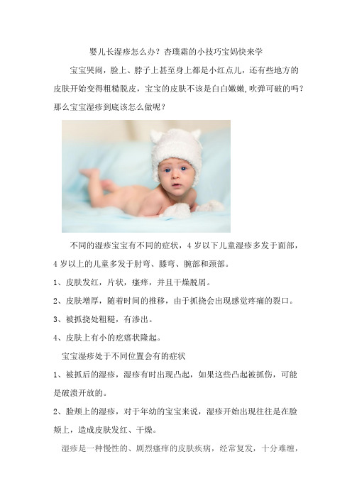 婴儿长湿疹怎么办？杏璞霜的小技巧宝妈快来学