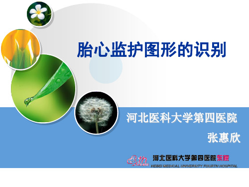 胎心监护图形识别 PPT课件