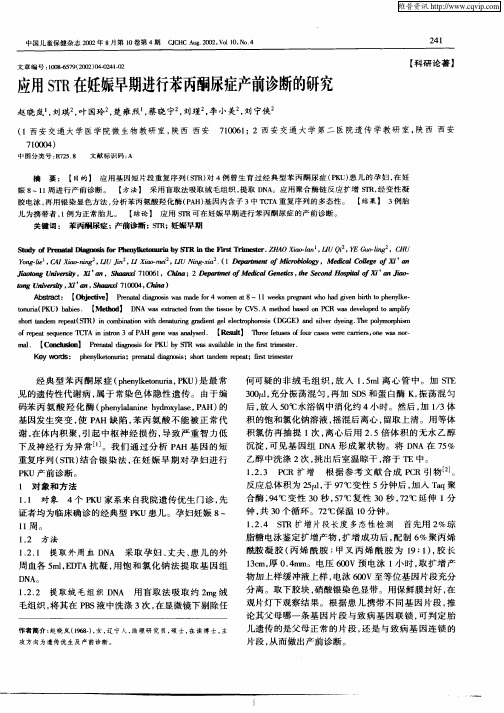 应用STR在妊娠早期进行苯丙酮尿症产前诊断的研究