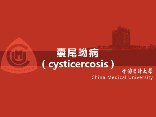 囊尾蚴病-精品医学课件