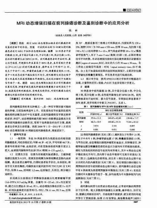 MRI动态增强扫描在前列腺癌诊断及鉴别诊断中的应用分析