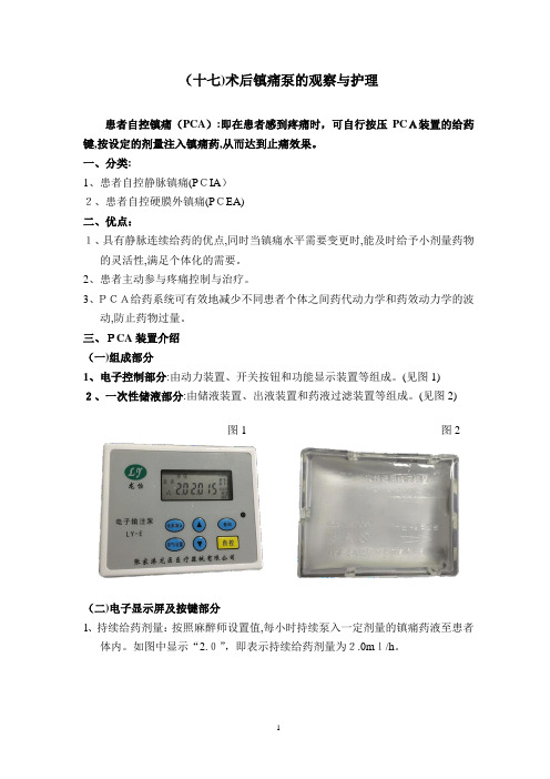 镇痛泵使用