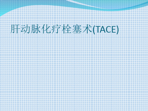 肝动脉化疗栓塞术(TACE)