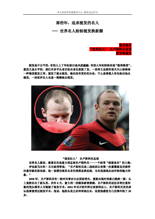那些年,追求植发的名人