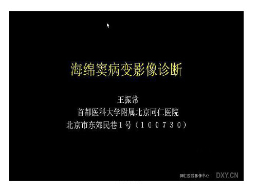 海绵窦病变课件