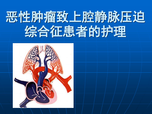 上腔静脉综合征护理