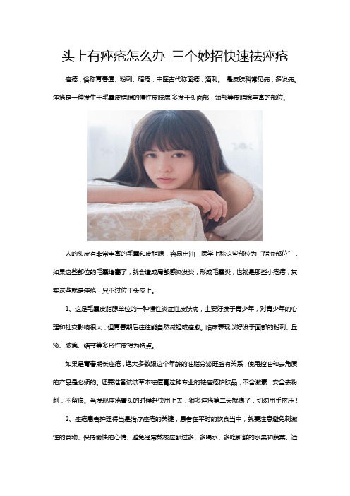 头上有痤疮怎么办 三个妙招快速祛痤疮