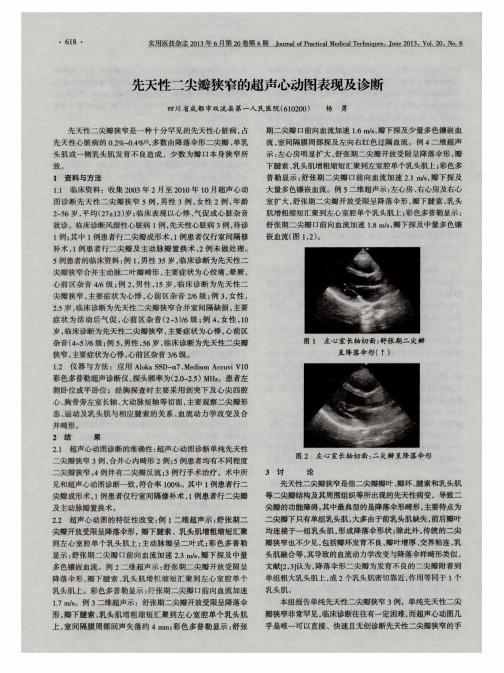 先天性二尖瓣狭窄的超声心动图表现及诊断