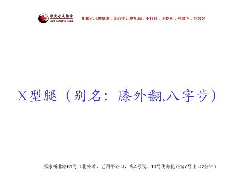 X型腿(别名：膝外翻,八字步)