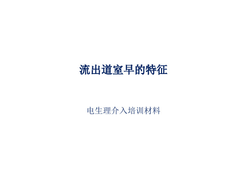 流出道室早特征