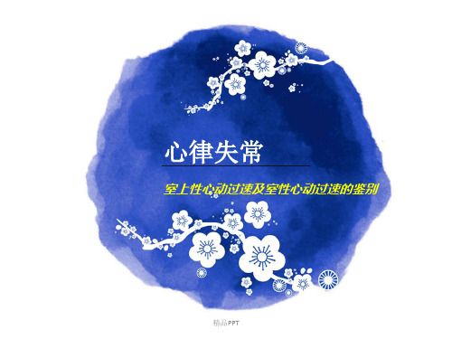 心律失常-室速和室上速的鉴别