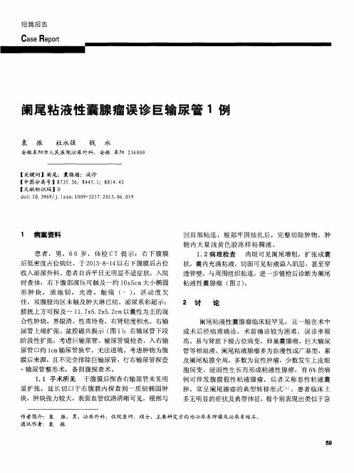 阑尾粘液性囊腺瘤误诊巨输尿管1例