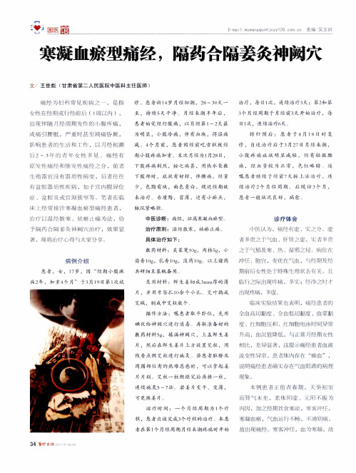 寒凝血瘀型痛经,隔药合隔姜灸神阙穴