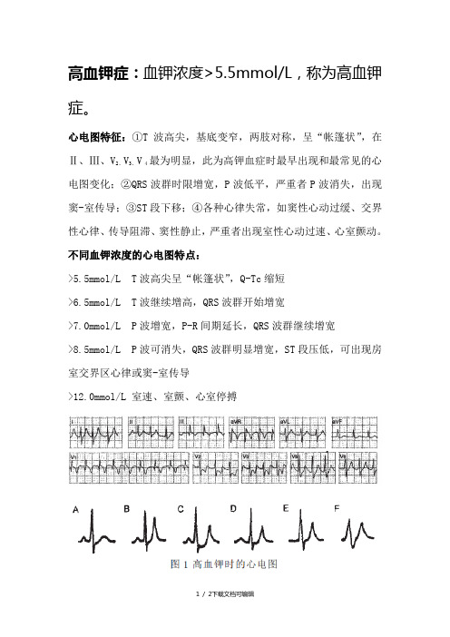 高血钾的心电图表现