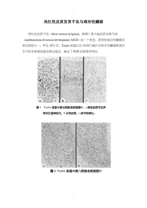 局灶性皮质发育不良的病理分型