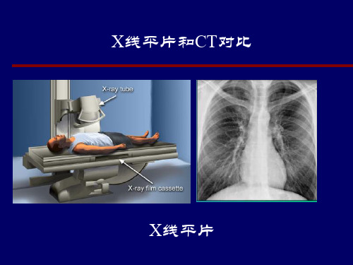 CT构造