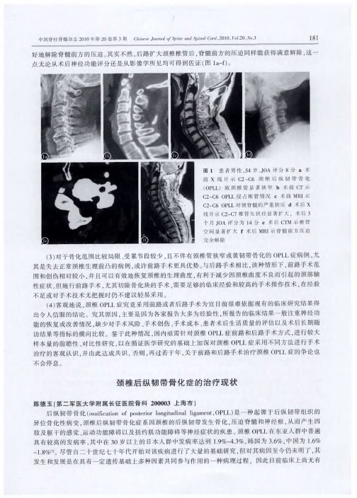 颈椎后纵韧带骨化症的治疗现状