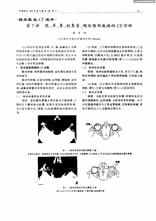 第7讲  眼、耳、鼻、副鼻窦、咽及喉部疾病的CT诊断