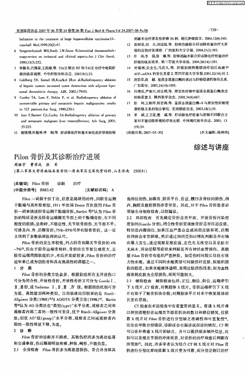 Pilon骨折及其诊断治疗进展