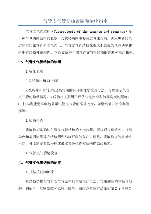 气管支气管结核诊断和治疗指南