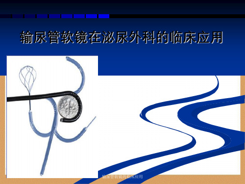 输尿管软镜的临床应用
