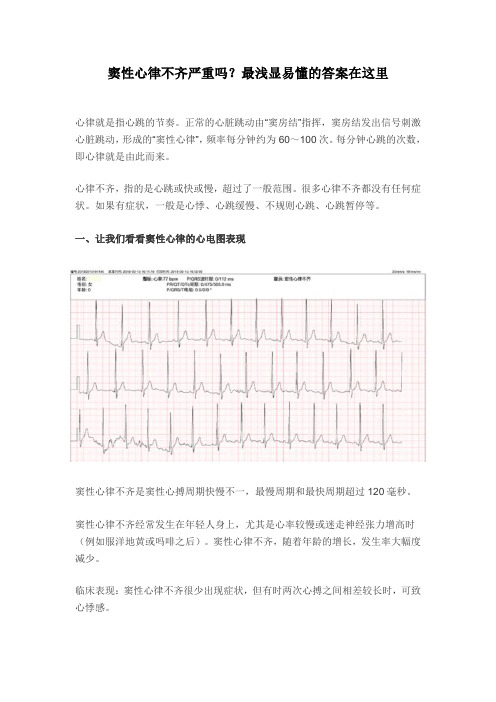 窦性心律不齐严重吗？最浅显易懂的答案在这里