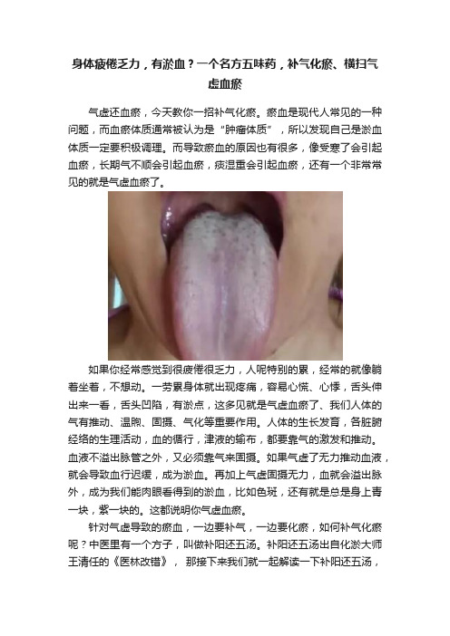 身体疲倦乏力，有淤血？一个名方五味药，补气化瘀、横扫气虚血瘀