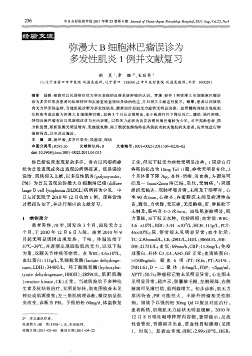 弥漫大B细胞淋巴瘤误诊为多发性肌炎1例并文献复习