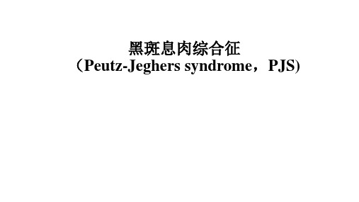 黑斑息肉综合征Peutz-Jeghers syndrome,PJS