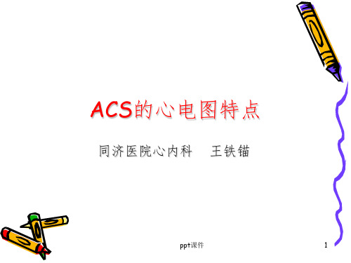 急性冠脉综合征的心电图PPT课件