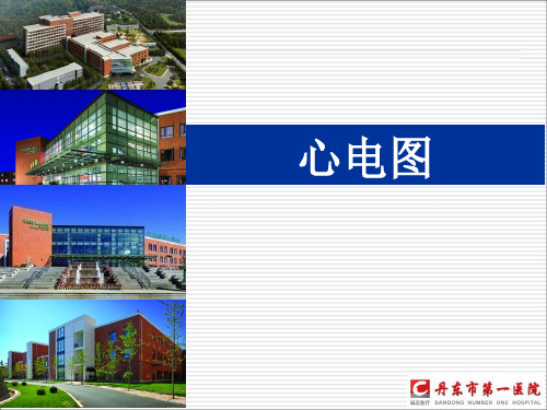 心电图