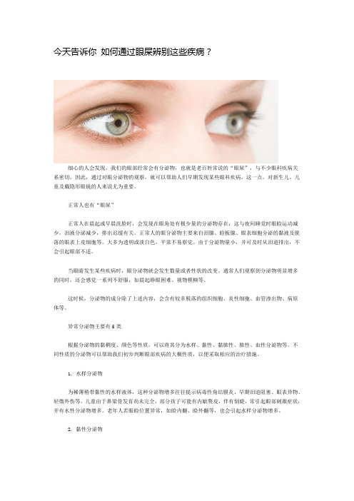今天告诉你 如何通过眼屎辨别这些疾病？