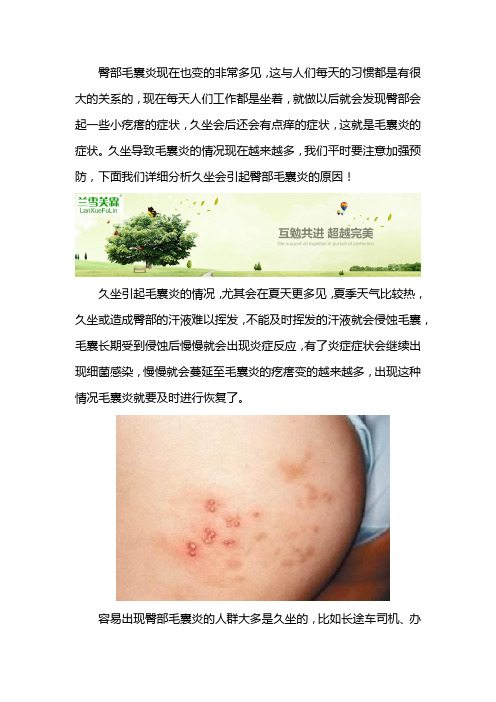 夏季久坐臀部有毛囊炎怎么办!