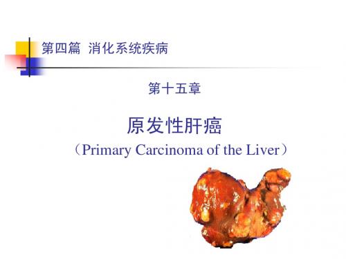 第四篇 第十五章 原发性肝癌