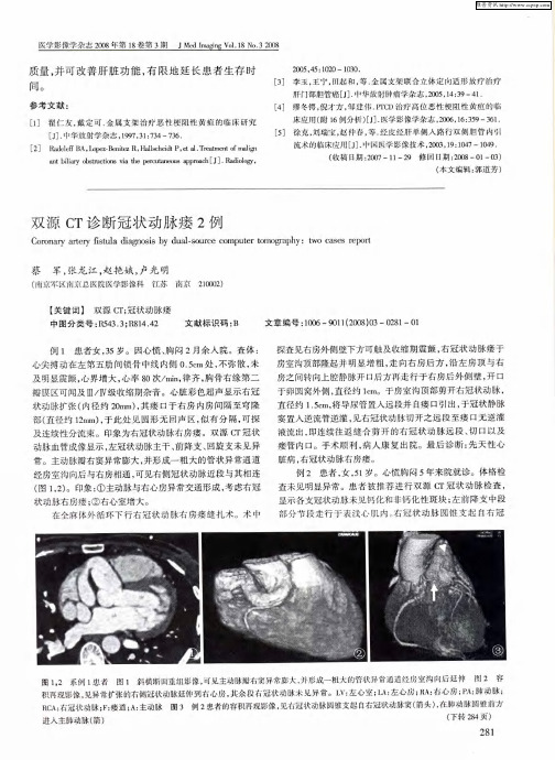 双源CT诊断冠状动脉瘘2例