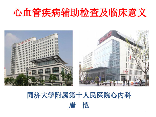 心血管疾病辅助检查及相关临床意义共60页
