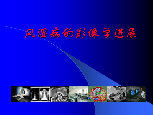 精品推荐医学影像诊断PPT课件图文详解完整版-风湿病影像学进展