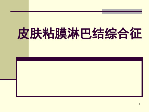 皮肤粘膜淋巴结综合征PPT课件