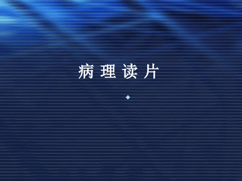 病理读片课件
