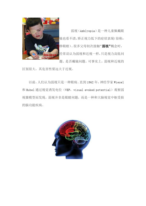 什么是弱视
