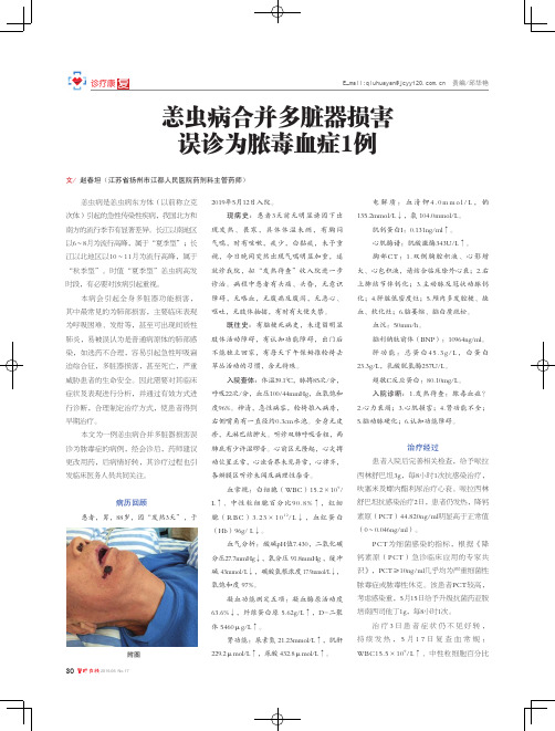 恙虫病合并多脏器损害误诊为脓毒血症1例
