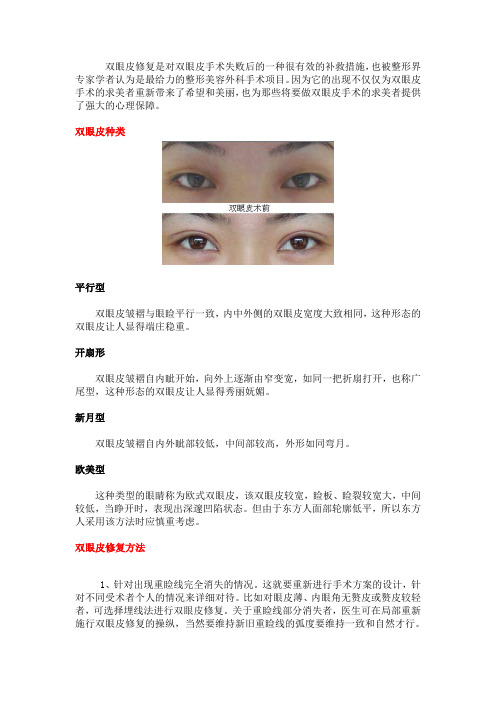 双眼皮修复正常恢复时间
